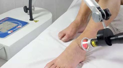 Laserterapia antalgica alla caviglia con Laserix