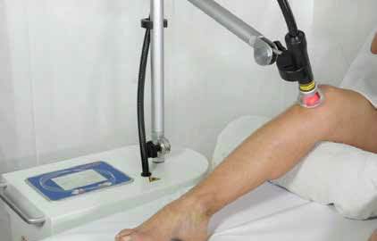 Laserterapia ginocchio con il Laserix